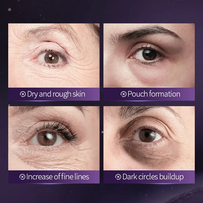 SADOER Starry Grape Collagen Eye Mask: 60pcs Anti-Dark Circle & Deep Hydration Patches