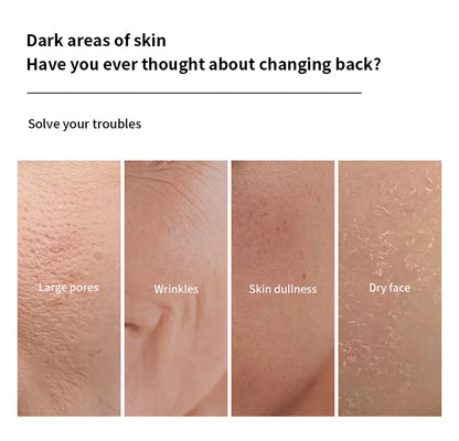 lakerain Bio-Collagen Deep Mask: 4-Piece Hydrating & Pore Refining Set