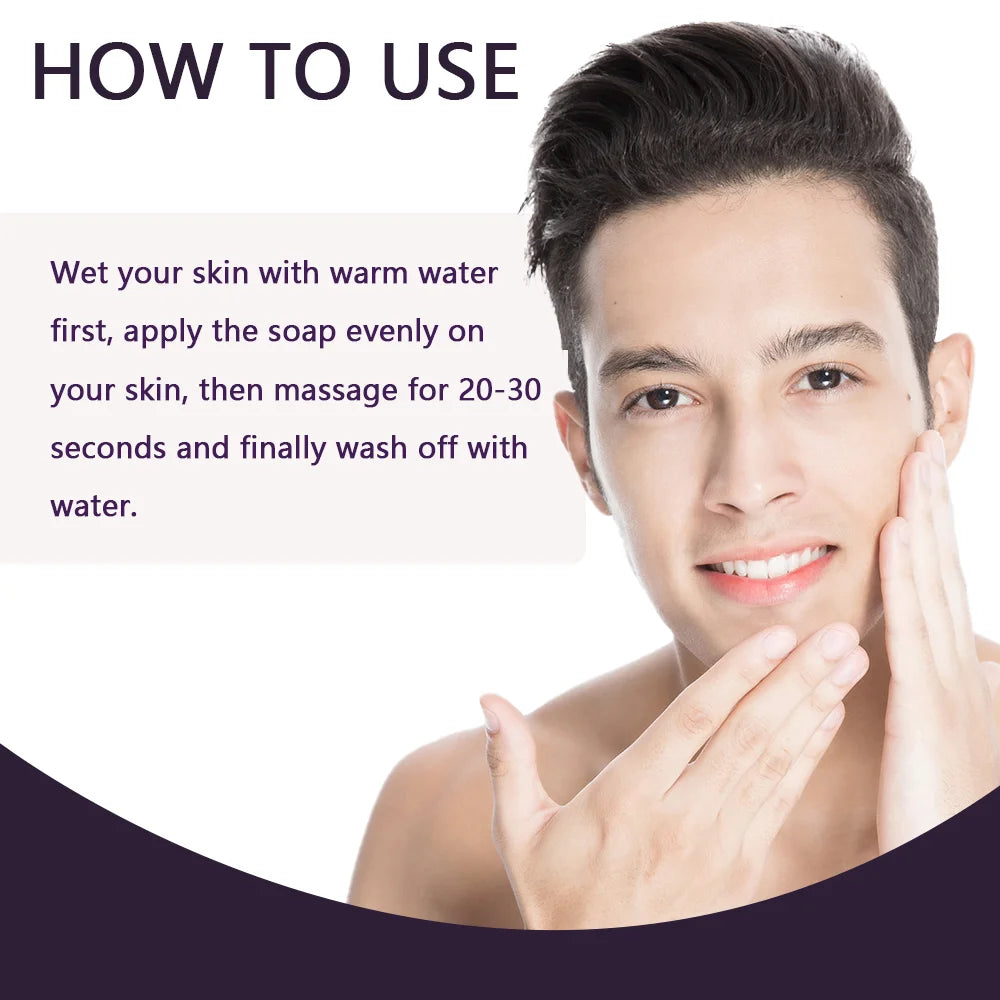 TYJR Kojic Acid & Turmeric Soap: Hyperpigmentation Repair & Brightening Bar
