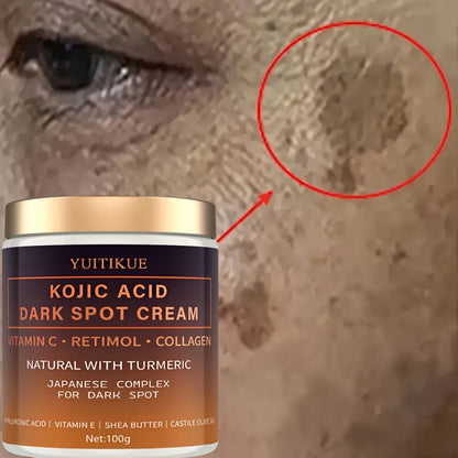 YUITIKUE Kojic Acid Dark Spot Cream: Japanese Complex with Retinol & Vitamin C