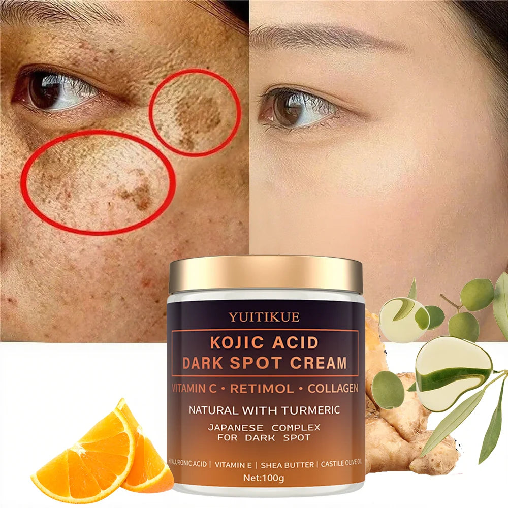 YUITIKUE Kojic Acid Dark Spot Cream: Japanese Complex with Retinol & Vitamin C