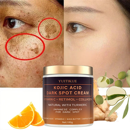 YUITIKUE Kojic Acid Dark Spot Cream: Japanese Complex with Retinol & Vitamin C
