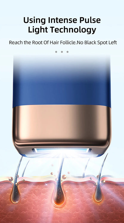 MLAY T14 Laser Hair Removal Ice Cooling IPL Laser Epilator Bikini Body Laser Depilador for Women Replaceable Lamp Hair Removal