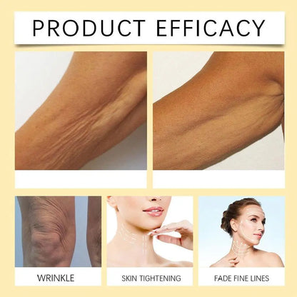 Before and after results showing skin tightening, wrinkle reduction, and fading of fine lines on arms, knees, and neck.